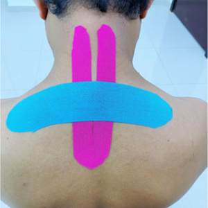 kinesiology tape nack