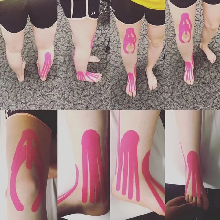 kinesiology tape for lymphedema2