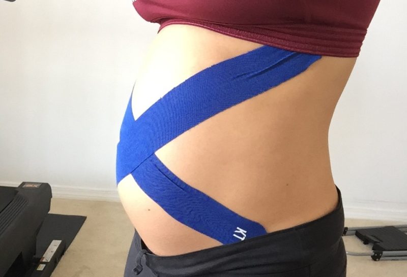 Kinesiology Tape for Pregnancy