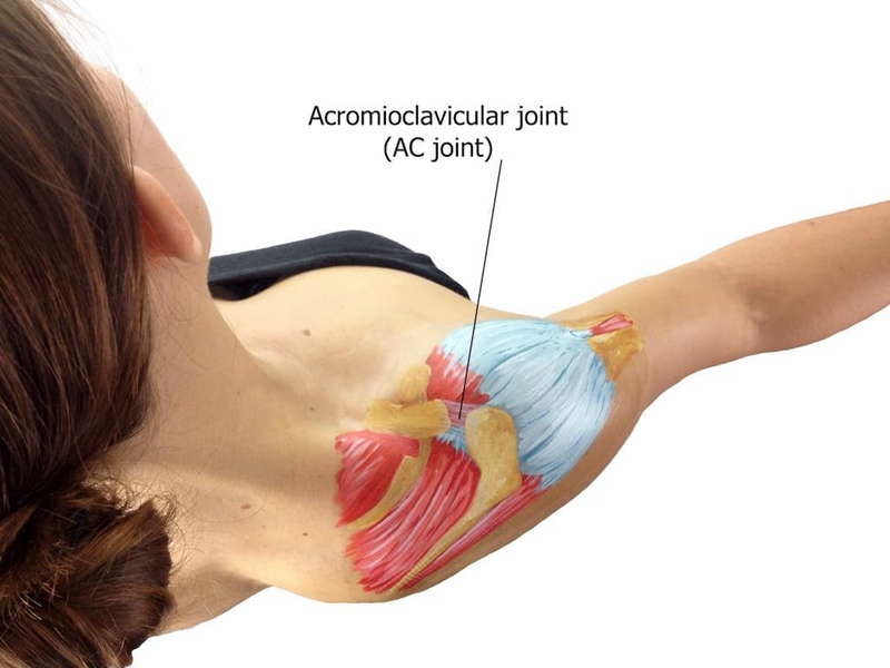 Where to put kinesiology tape for ac joint