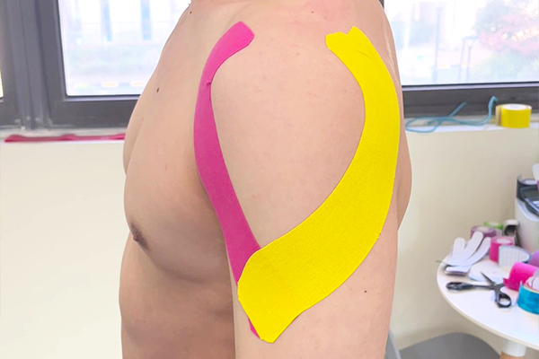 kinesiology tape on shoulder