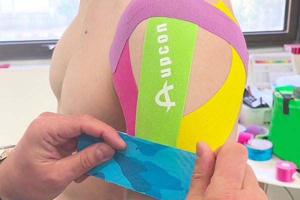 kinesiology tape for Deltoid Syndrome