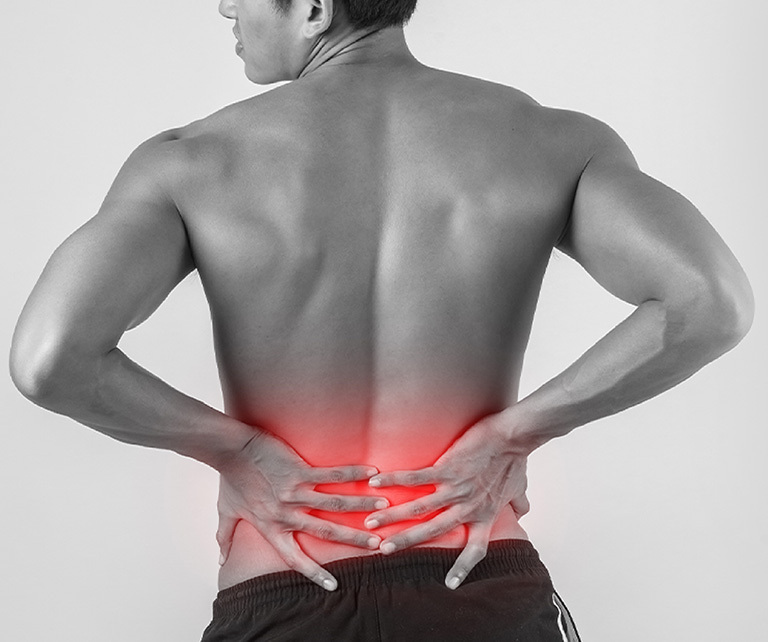 Schmerzen im unteren Rückenbereich
