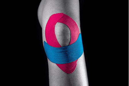 patellar taping for knee