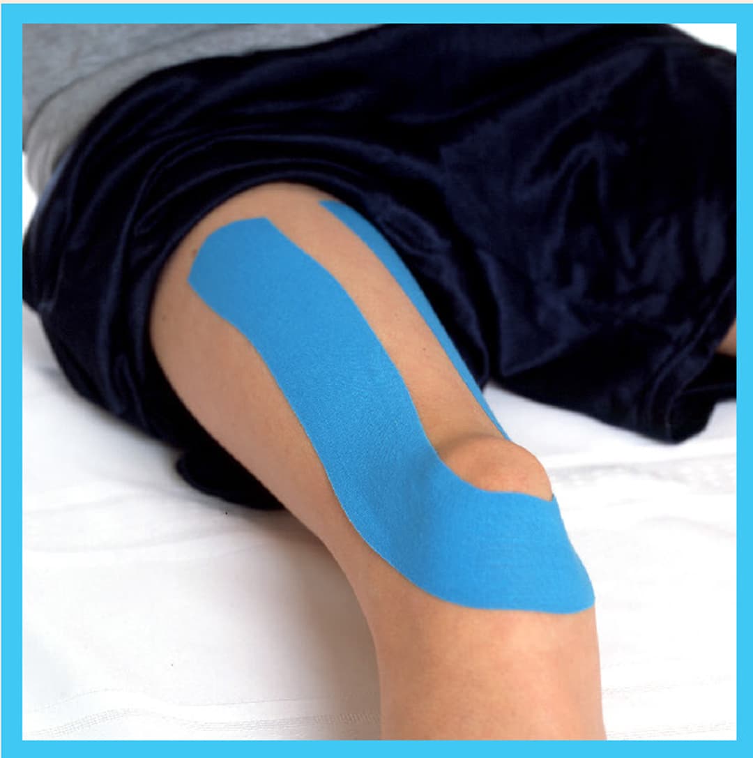 Does patellar taping work aupcon