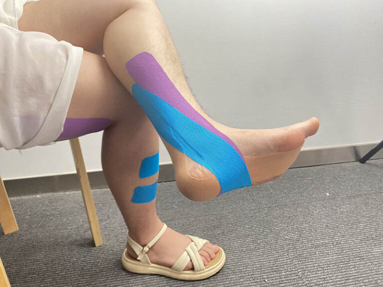 kinesiologietape voor plantaire fasciitis