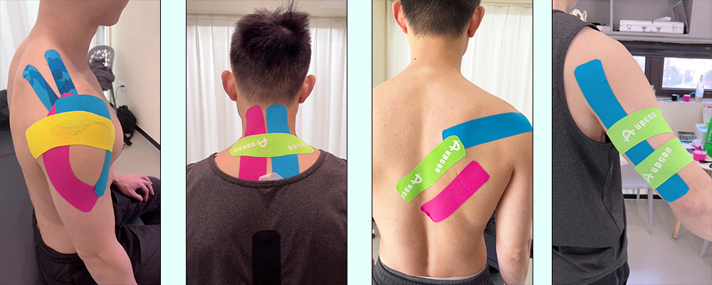 Application of Shoulder Kinesiology Tape