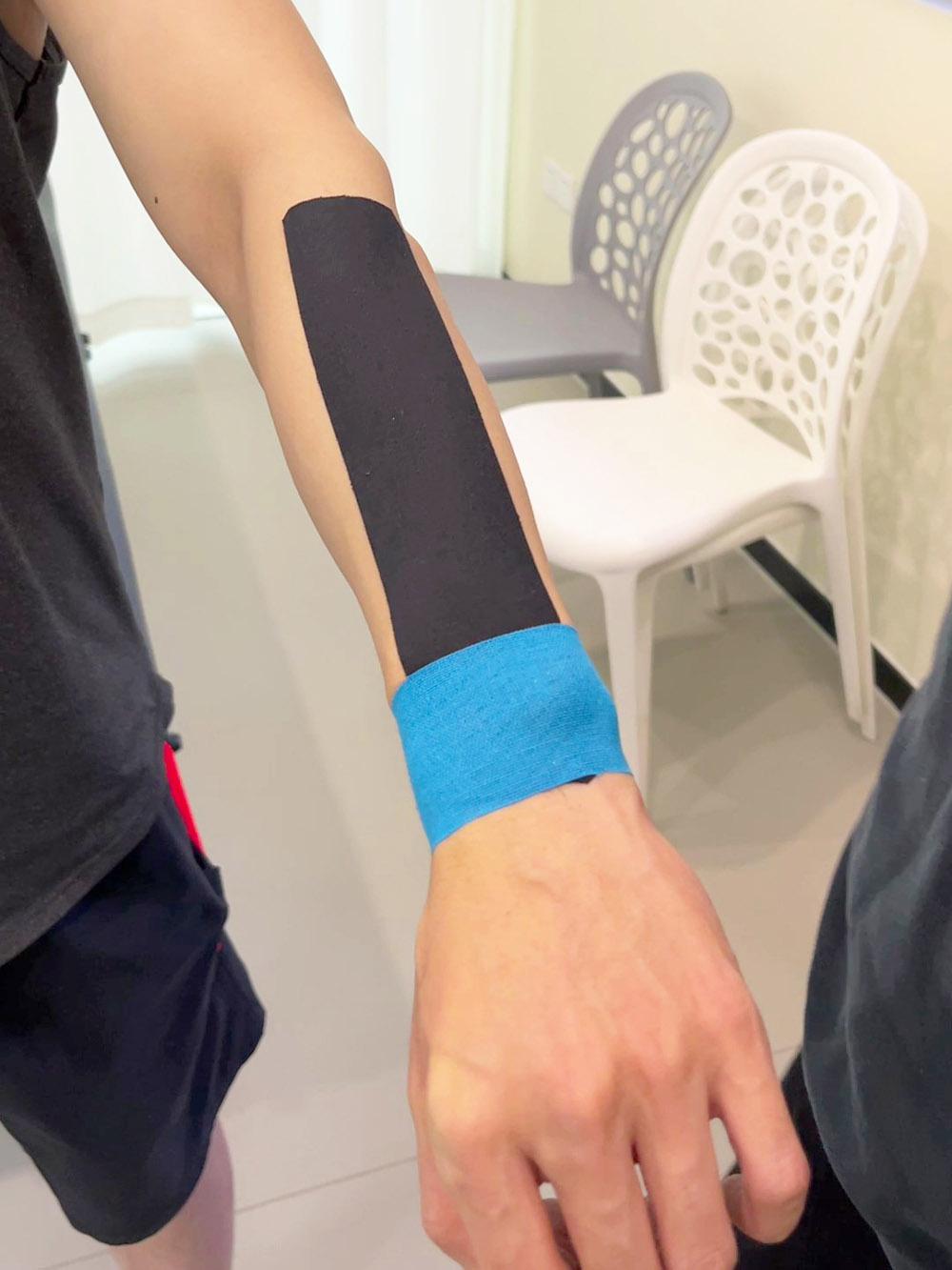 Band für Handgelenkstendinitis