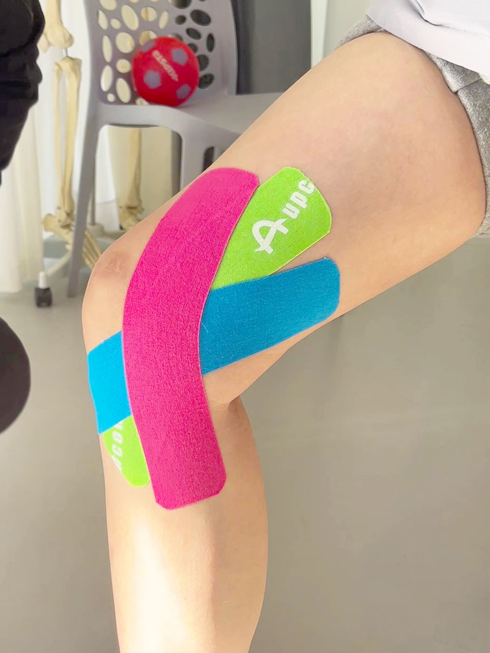 Taping für mediales Knie