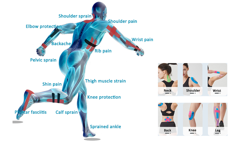 How to apply kinesiology tape to the body?