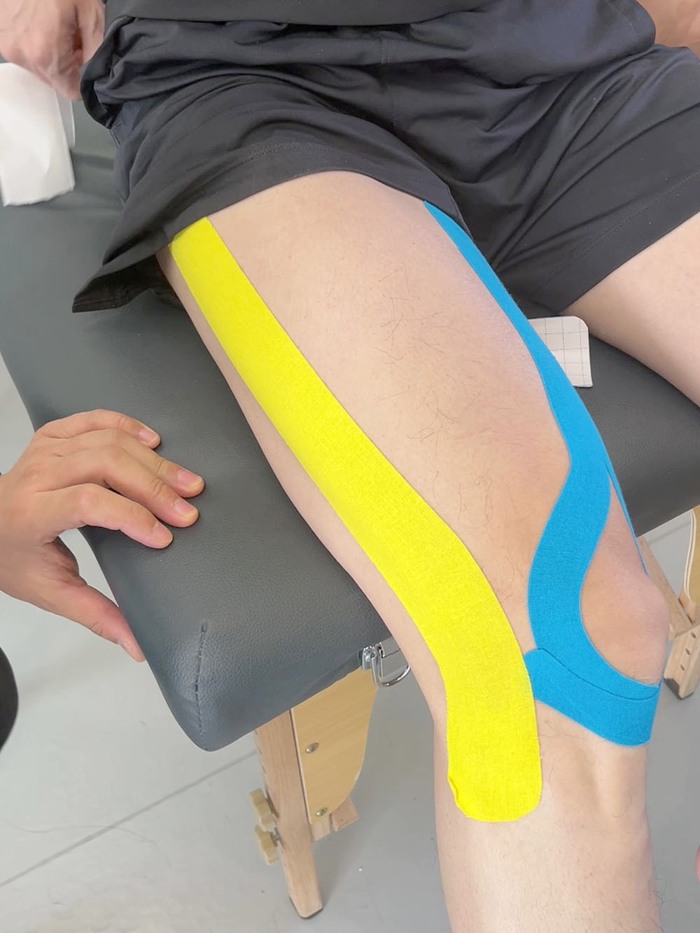 Kinesiotape bei Quadrizeps-Sehnenentzündung verwenden