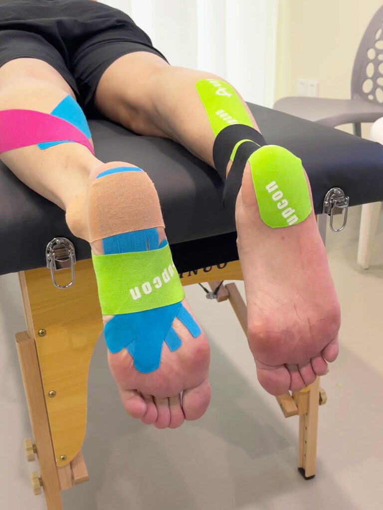 Plantar-Faszien-Bänder