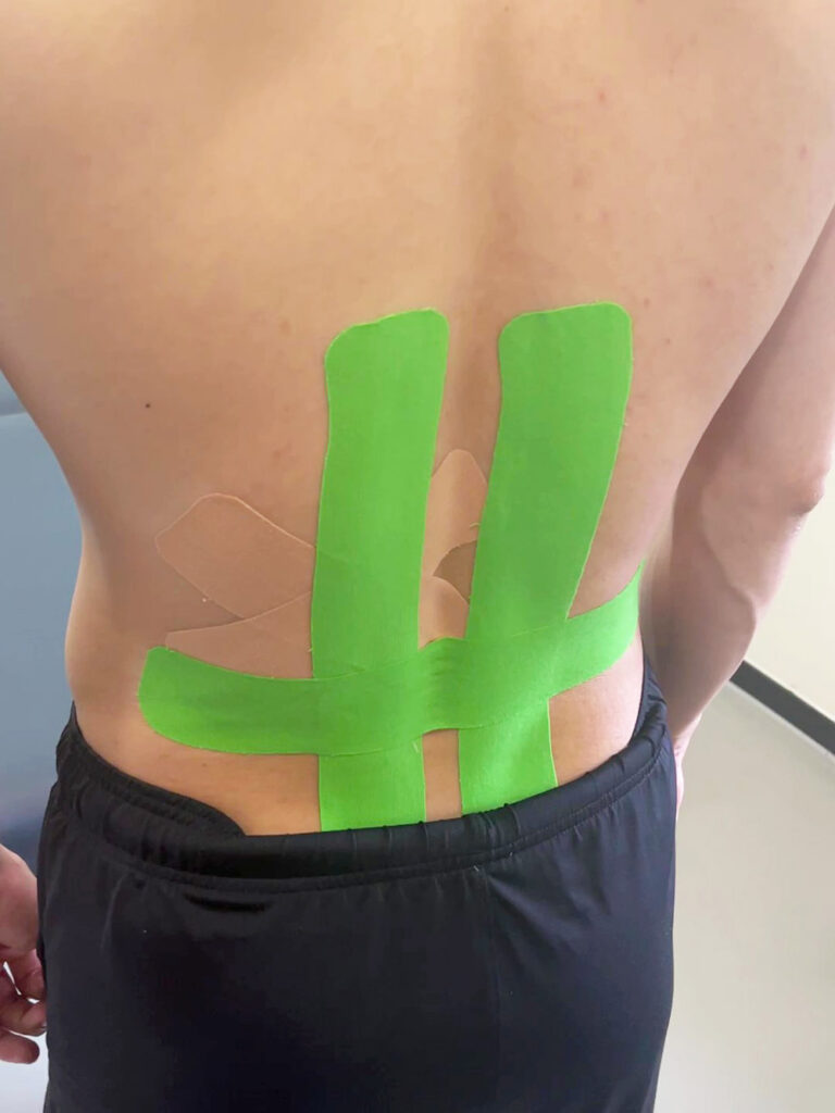 Kinesiologieband für die Lendenwirbelsäule