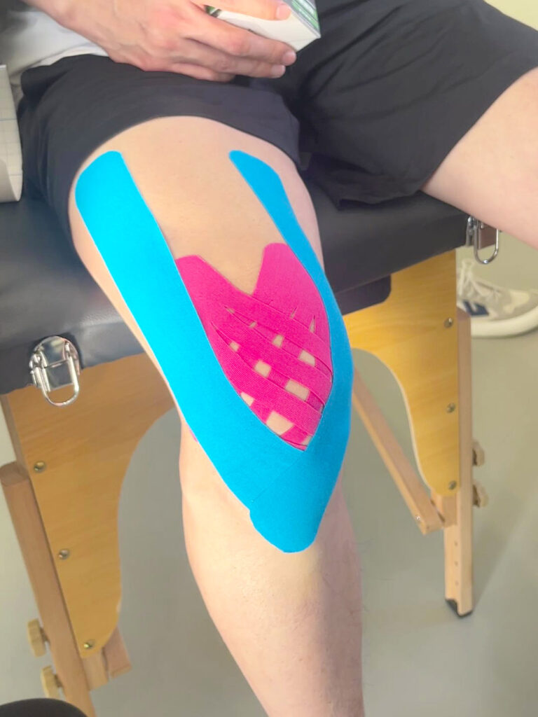 Kinesiologie-Band gerissener Meniskus