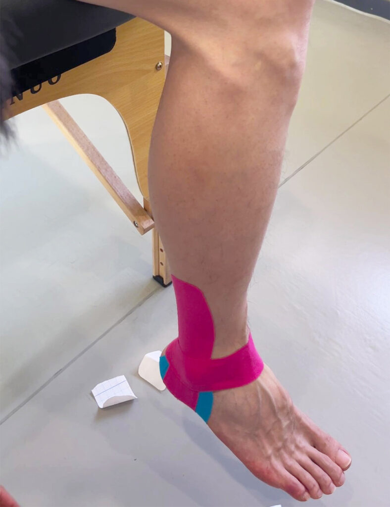 wie man Kinesiologieband für den Knöchel verwendet