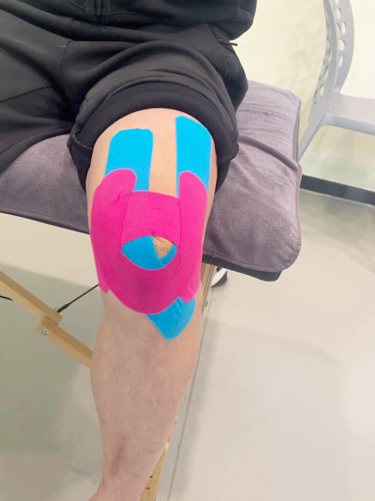 Kinesiologisches Tape bei patellofemoralen Schmerzen verwenden