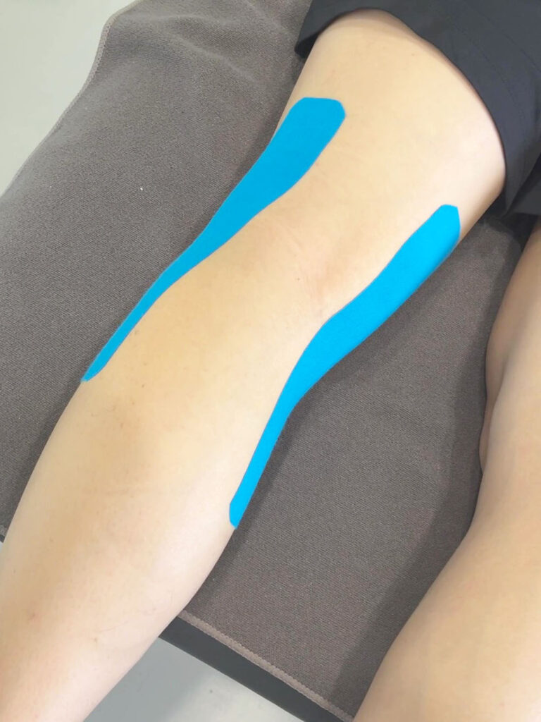 Kinesiologisches Band für die Kniesehne