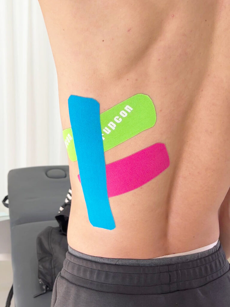 Kinesiologieband geprellte Rippen