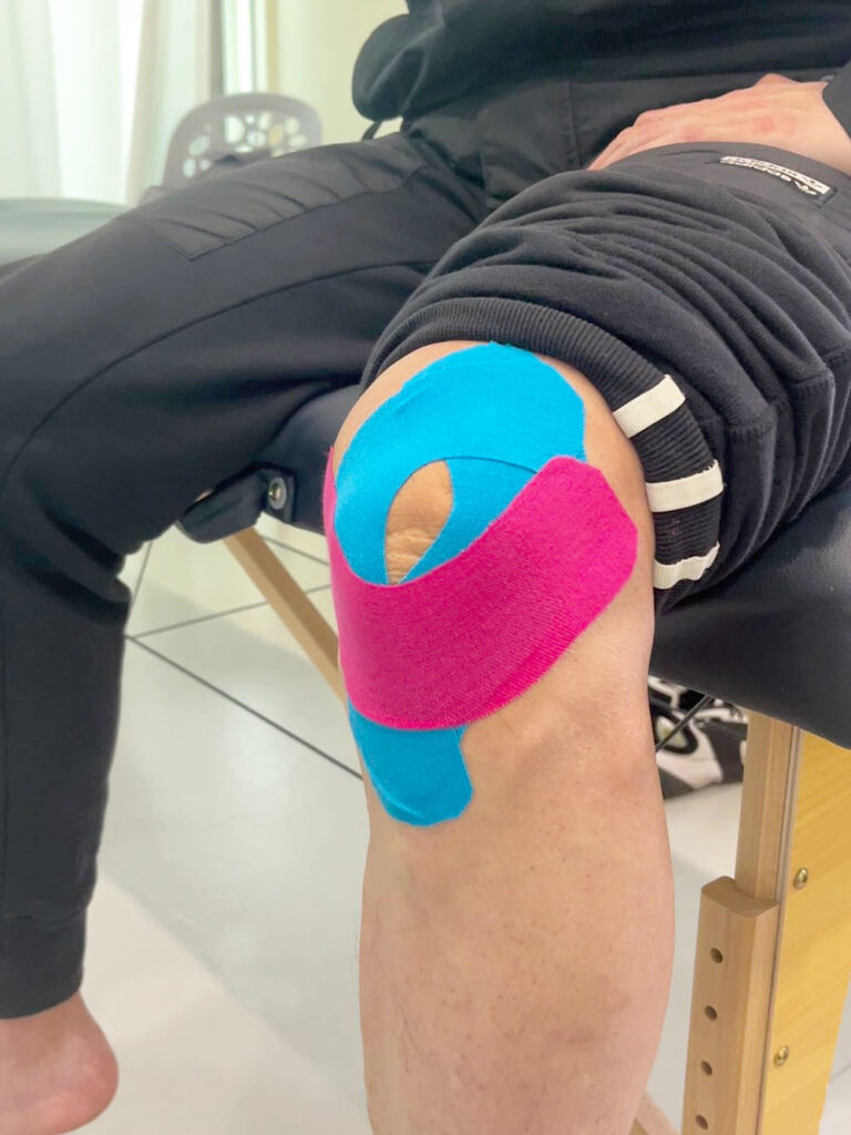 Kinesiologie-Tape für das vordere Kreuzband des Knies