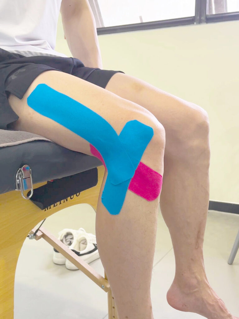 lcl verletzung kinesiologisches band