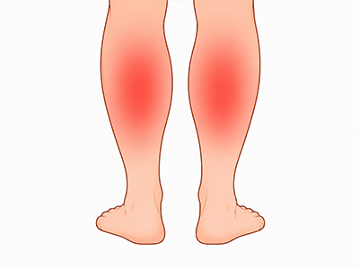 Post-workout Soreness