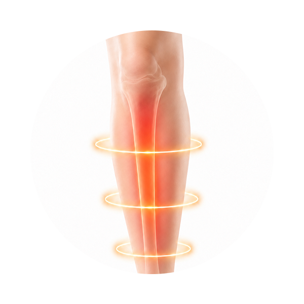 REDUCE SHIN SPLINT